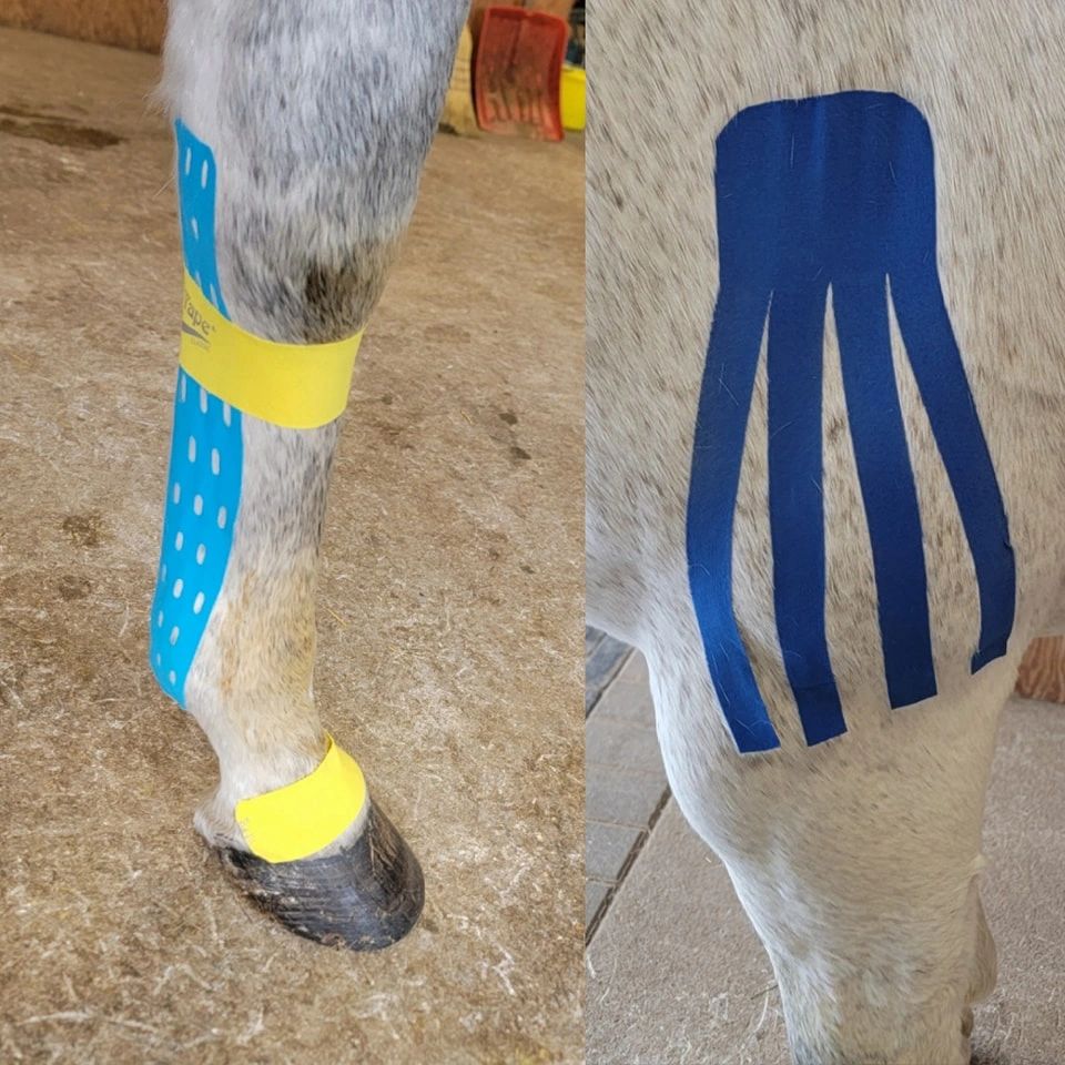 Two different types of kinesiology tape..